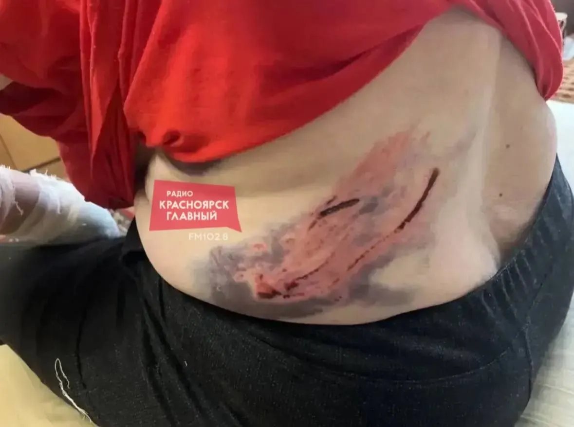 В магазине на Гладкова женщина с большим псом без намордника укусила пенсионерку. Пострадавшая обратилась в полицию в тот же день, но заявление и направление на судмедэкспертизу оформили лишь позже из‑за отсутствия свободных сотрудников.